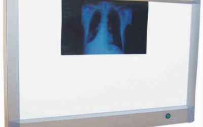 Xray viewer Xray viewer